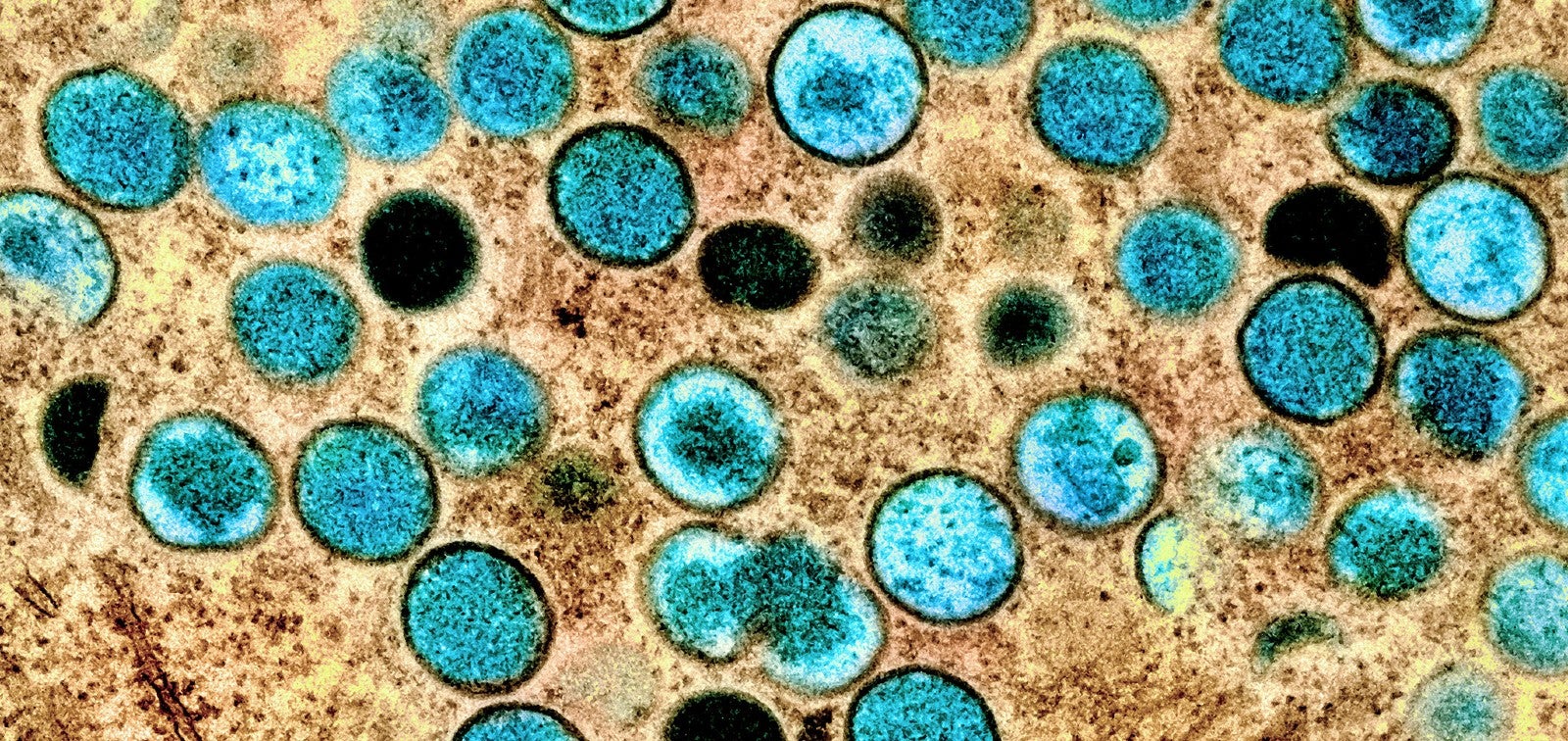 El investigador Salvador Peiró, sobre el virus MPOX: "El riesgo para los países desarrollados es muy limitado" El investigador Salvador Peiró, sobre el virus MPOX: "El riesgo para los países desarrollados es muy limitado"