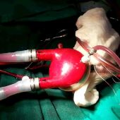 El hospital Reina Sofía implanta a un niño de tres años corazón artificial 