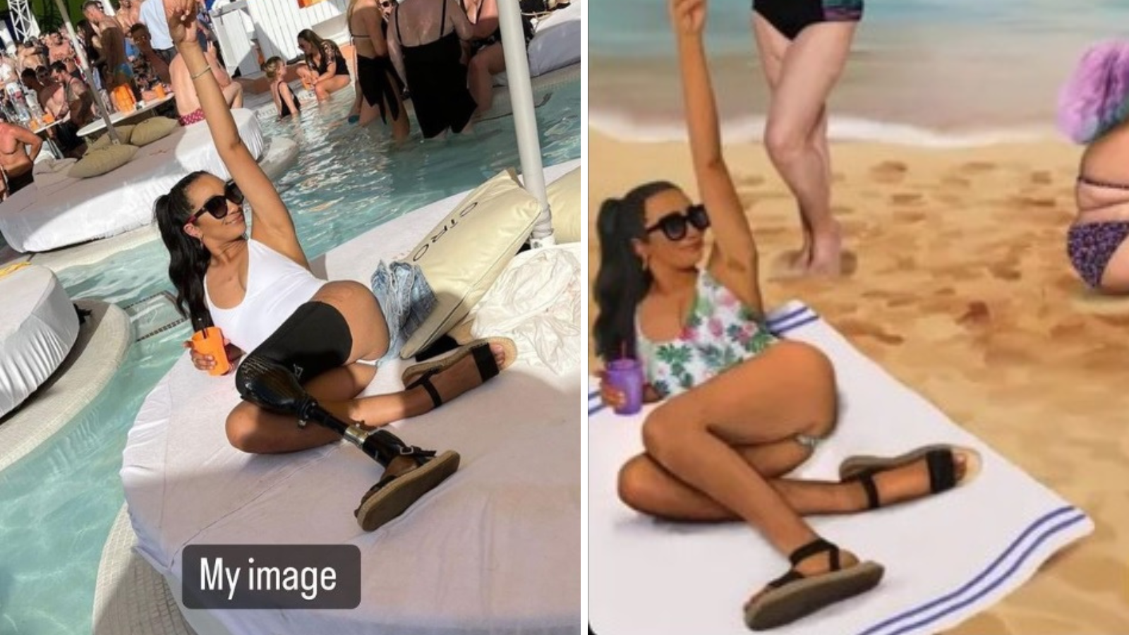 Otra modelo denuncia la campaña de Igualdad por editar su cuerpo y borrar su prótesis en la pierna Otra modelo denuncia la campaña de Igualdad por editar su cuerpo y borrar su prótesis en la pierna