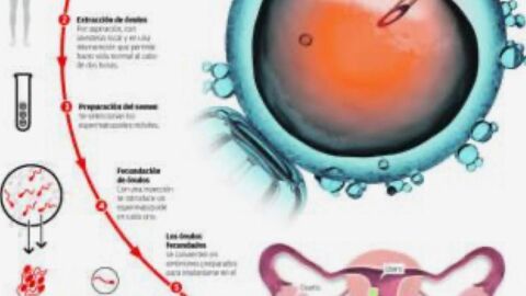 Reproducci&oacute;n asistida