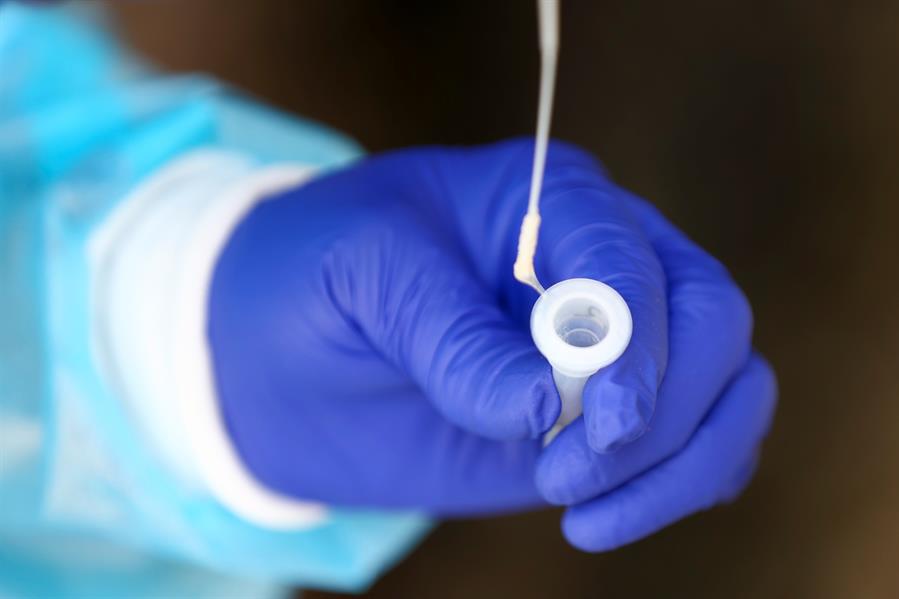 Datos covid España: los indicadores bajan a niveles previos a ómicron Datos covid España: los indicadores bajan a niveles previos a ómicron