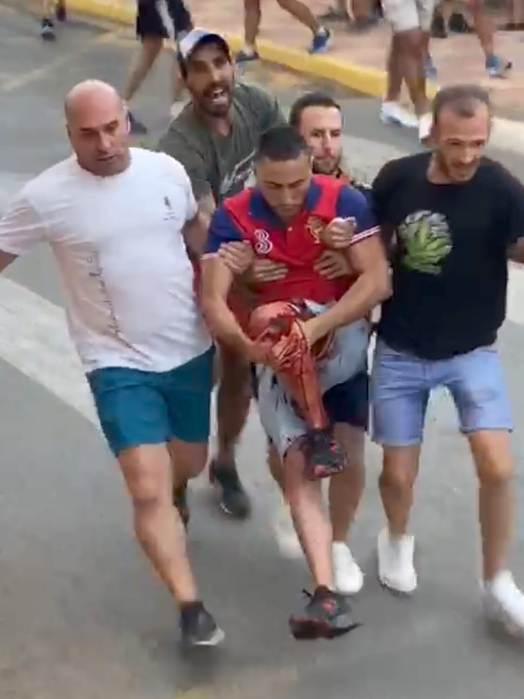 Gran participación en el encierro "fernanduco" de Fernán Caballero y un herido por asta de toro Gran participación en el encierro "fernanduco" de Fernán Caballero y un herido por asta de toro