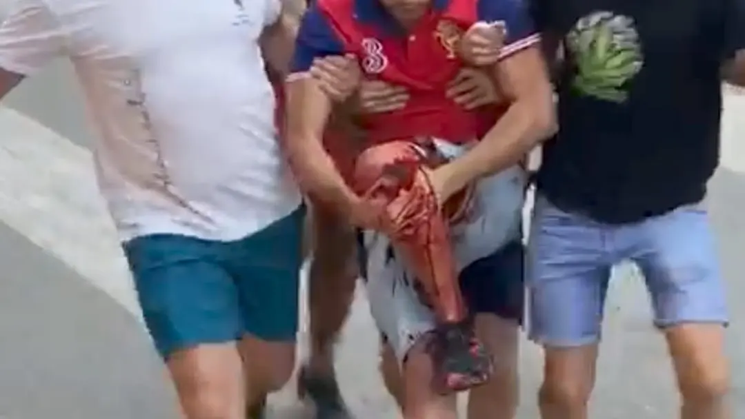 Herido por asta de toro en Fernán Caballero Herido por asta de toro en Fernán Caballero