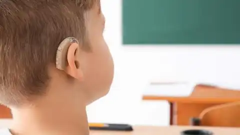 hipoacusia hipoacusia