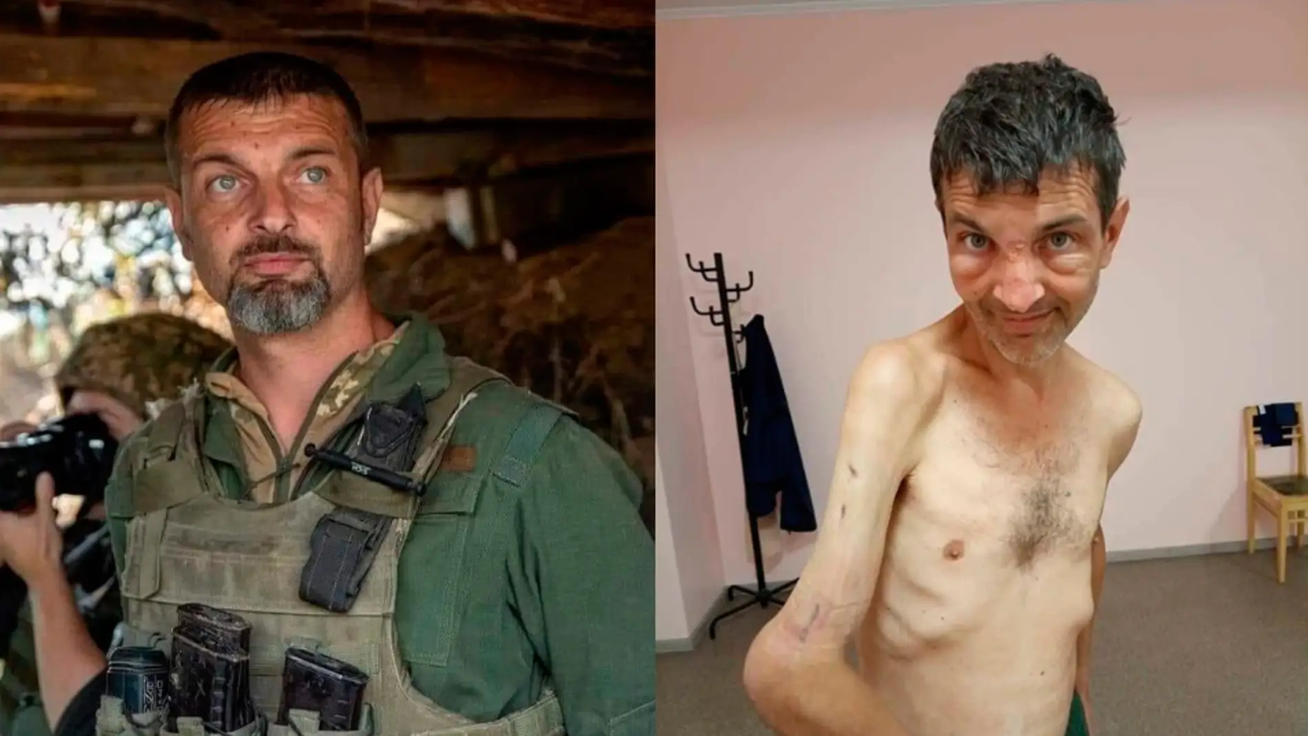 La dura imagen del antes y el después de un soldado ucraniano liberado en Rusia