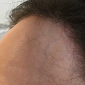 Encarnita Martínez nos habla hoy de cómo trata los casos de grave pérdida de cabello en las mujeres Encarnita Martínez nos habla hoy de cómo trata los casos de grave pérdida de cabello en las mujeres