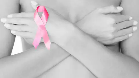 Cáncer de mama Cáncer de mama