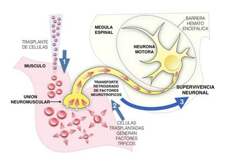 El Instituto de Neurociencias de la UMH de Elche busca pacientes de ELA para completar el ensayo clínico de un nuevo tratamiento El Instituto de Neurociencias de la UMH de Elche busca pacientes de ELA para completar el ensayo clínico de un nuevo tratamiento