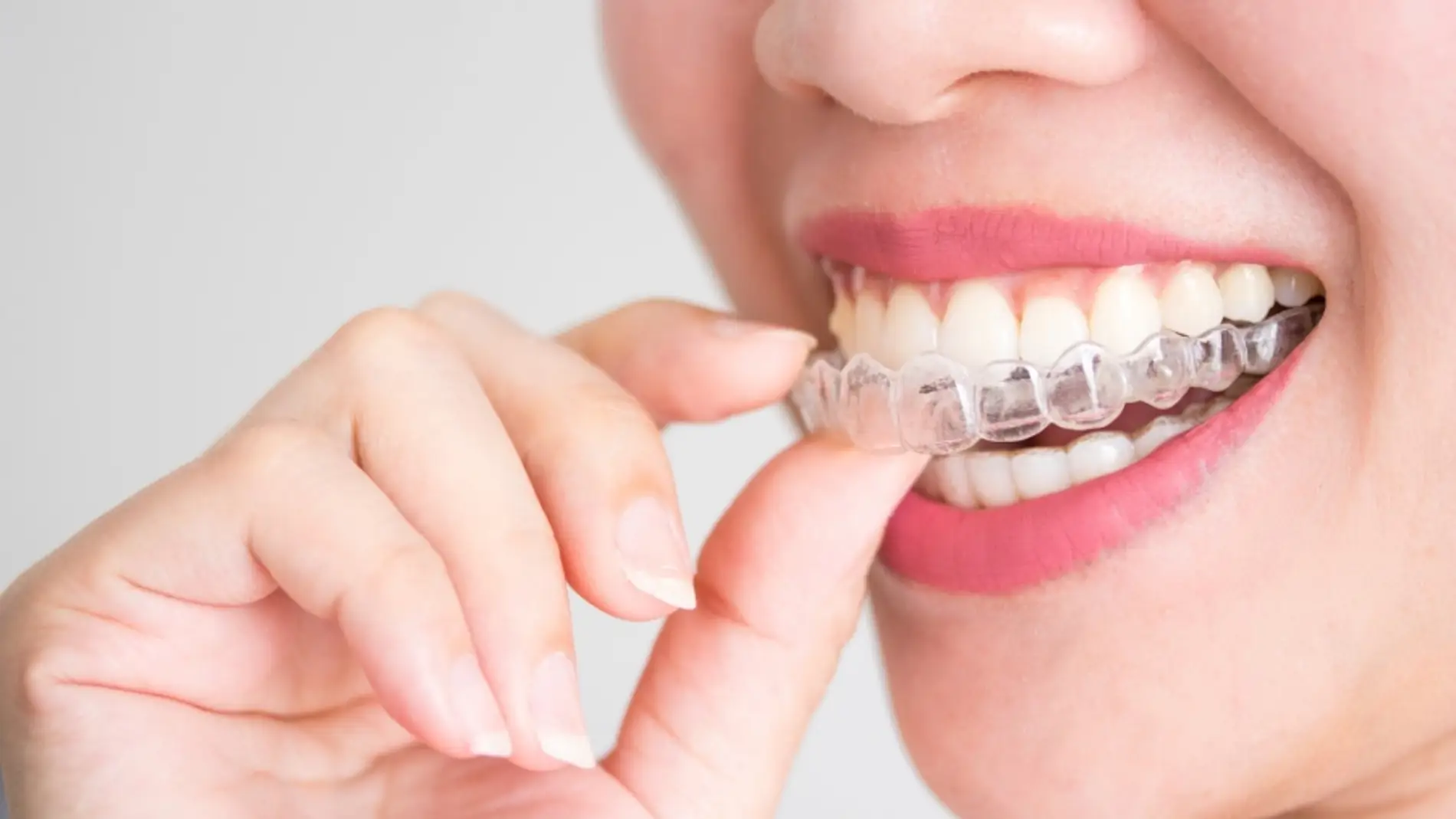 El Colegio Oficial de Dentistas de Málaga advierte sobre los peligros de comprar tratamientos dentales por internet