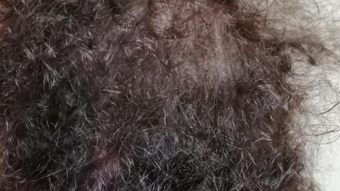 pelo