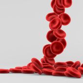 Los farmacéuticos recuerdan que la falta de hierro es la causa más común de la anemia