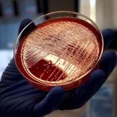 Vista de un cultivo de listeriosis en una placa de Petri