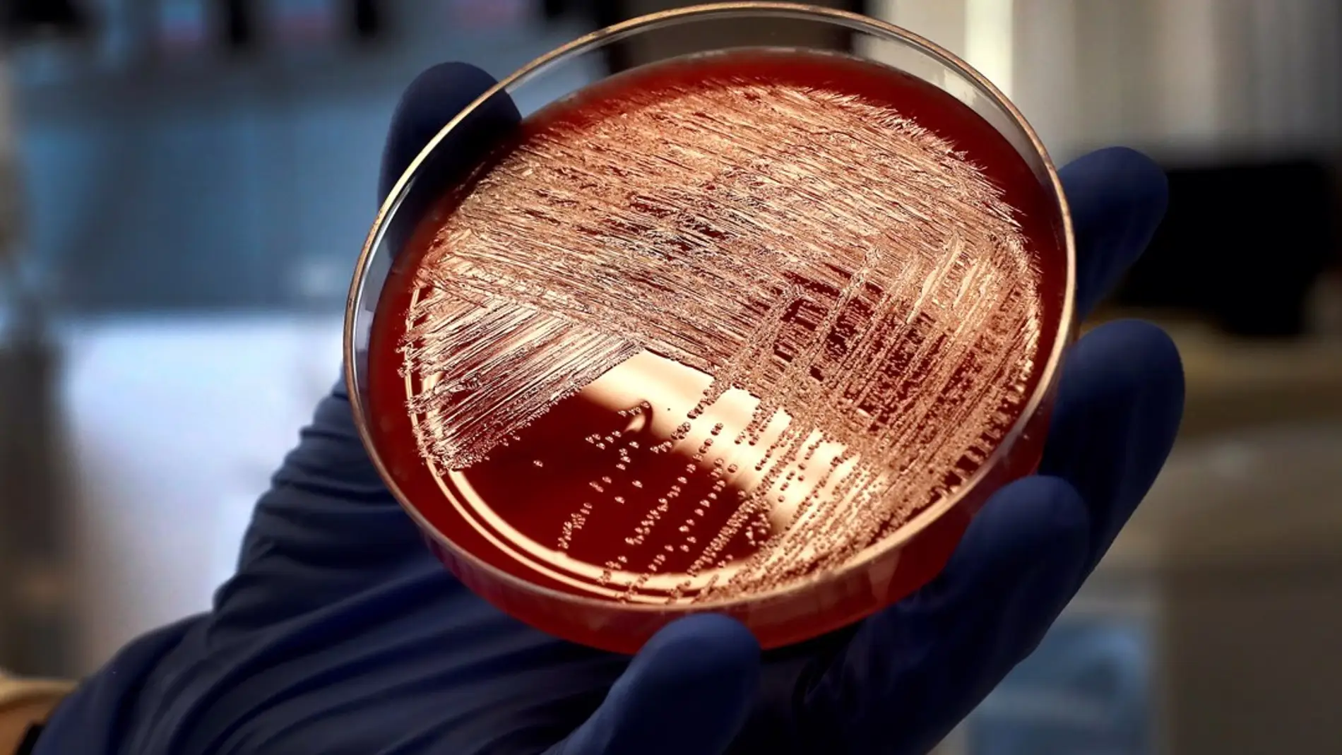 Vista de un cultivo de listeriosis en una placa de Petri