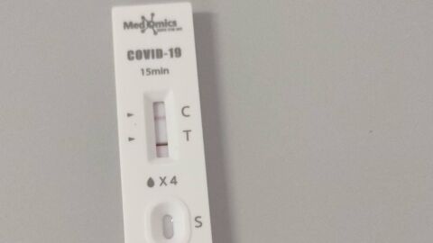Cinco personas fallecen en la &uacute;ltima semana con Covid en Extremadura, que contabiliza 48 hospitalizados