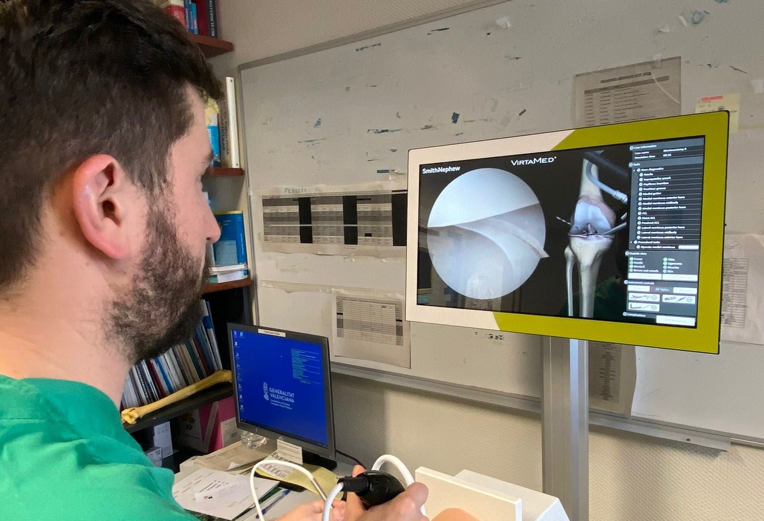 El hospital de Torrevieja pionero en utilizar un navegador para la realización de osteotomías de rodilla El hospital de Torrevieja pionero en utilizar un navegador para la realización de osteotomías de rodilla