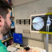 El hospital de Torrevieja pionero en utilizar un navegador para la realización de osteotomías de rodilla 