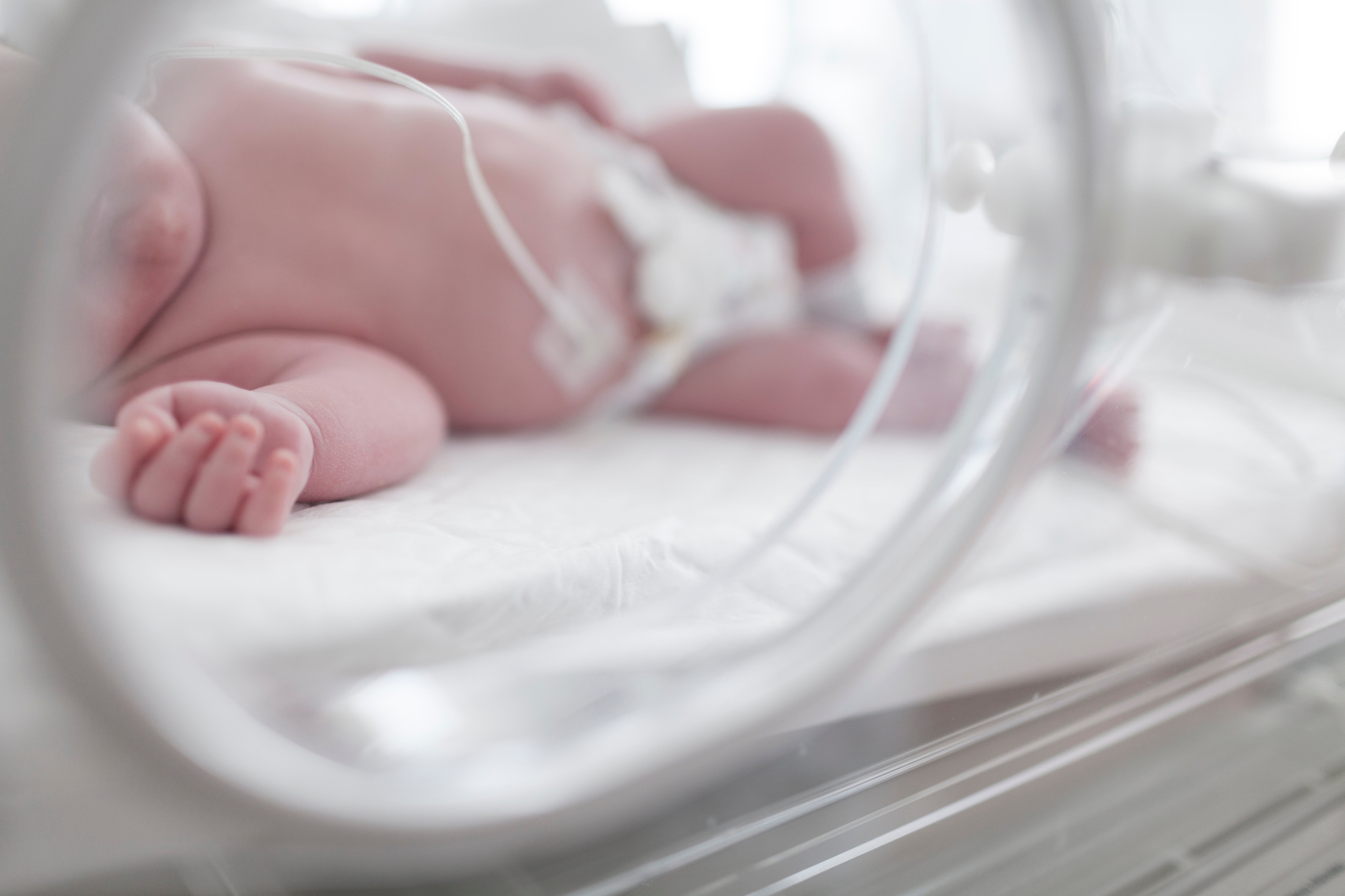 El pie zambo y la displasia, casos más frecuentes en traumatología infantil del recién nacido El pie zambo y la displasia, casos más frecuentes en traumatología infantil del recién nacido