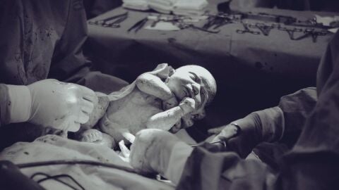 Imagen de archivo de un parto