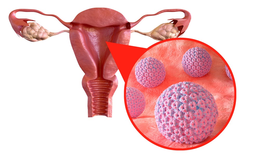 Jornada sobre el VPH, ¿Qué debería saber? Jornada sobre el VPH, ¿Qué debería saber?