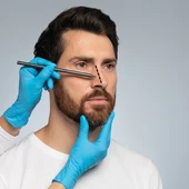 Menos dolor postoperatorio, mayor facilidad para respirar, mejores resultados estéticos y una rápida recuperación gracias a la cirugía nasal sin taponamiento en Quirónsalud Torrevieja Menos dolor postoperatorio, mayor facilidad para respirar, mejores resultados estéticos y una rápida recuperación gracias a la cirugía nasal sin taponamiento en Quirónsalud Torrevieja