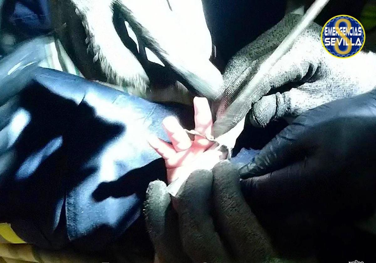 Los bomberos liberan la mano de un bebé que tenía dos dedos atrapados en el desagüe del lavabo Los bomberos liberan la mano de un bebé que tenía dos dedos atrapados en el desagüe del lavabo