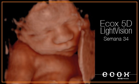 Ecografías emocionales para ver al feto "como nunca antes" y reforzar vínculos Ecografías emocionales para ver al feto "como nunca antes" y reforzar vínculos