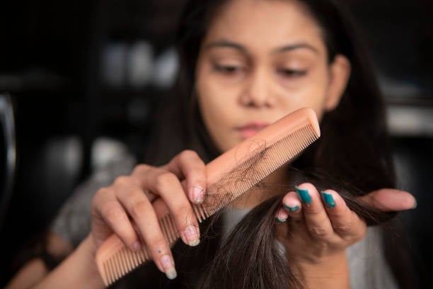 Centros Grasman cuidan de tu cabello, prevención, tratamiento y soluciones en caso de caida Centros Grasman cuidan de tu cabello, prevención, tratamiento y soluciones en caso de caida