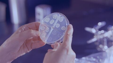 &iquest;Se puede transmitir la tuberculosis de animales a humanos? &iquest;existe una vacuna?