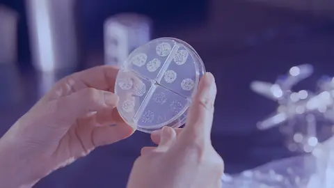 Tuberculosis ¿Se puede transmitir la tuberculosis de animales a humanos? ¿existe una vacuna?