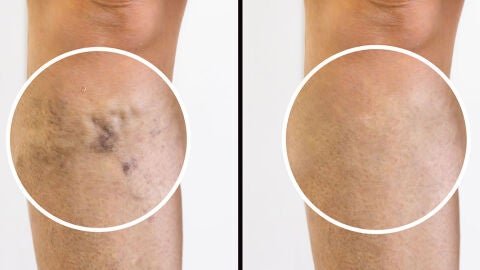 Centro Dermatol&oacute;gico Est&eacute;tico