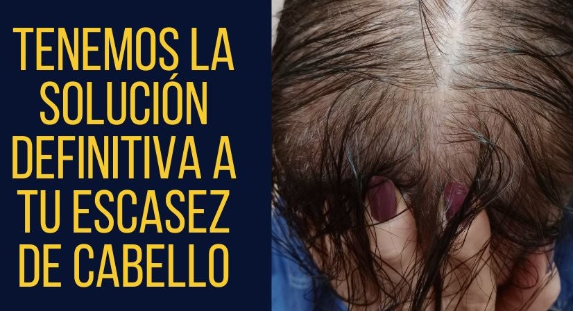 Hoy abordamos con Encarnita Martínez las soluciones ante la pérdida de cabello en mujeres y hombres Hoy abordamos con Encarnita Martínez las soluciones ante la pérdida de cabello en mujeres y hombres