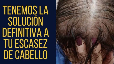 capilar