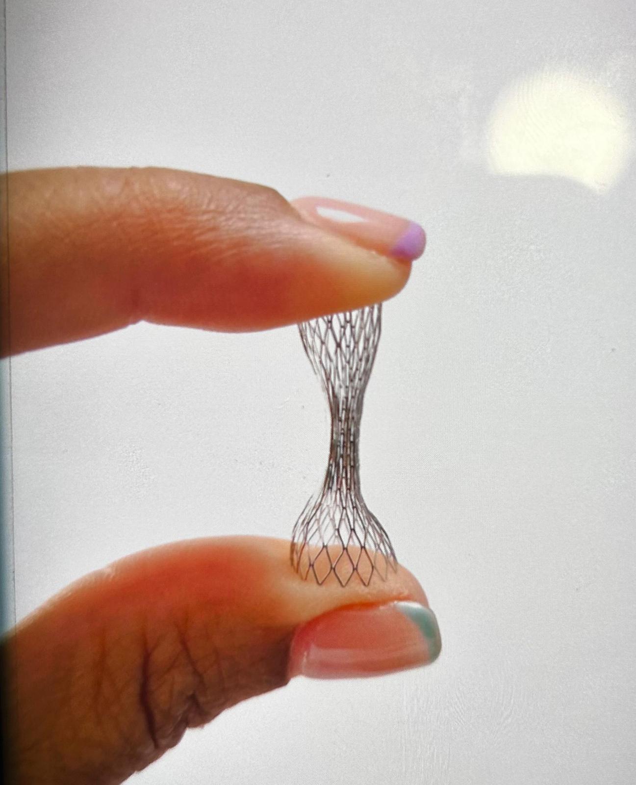 Cardiología del Hospital General de Elche implanta una novedosa prótesis para el control de los síntomas de angina de pecho Cardiología del Hospital General de Elche implanta una novedosa prótesis para el control de los síntomas de angina de pecho