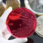 Zoonosis Zoonosis