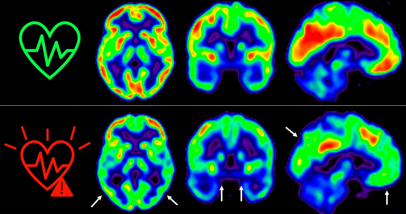 Cómo influye el deporte, las emociones y el sueño en nuestro cerebro Cómo influye el deporte, las emociones y el sueño en nuestro cerebro
