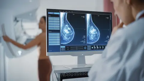 El cáncer de mama es uno de los que presenta mayor incidencia entre la población menor de 50 años El cáncer de mama es uno de los que presenta mayor incidencia entre la población menor de 50 años