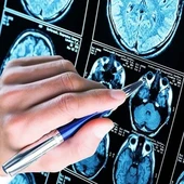 L’Alzheimer afecta moltes persones grans de Catalunya L’Alzheimer afecta moltes persones grans de Catalunya