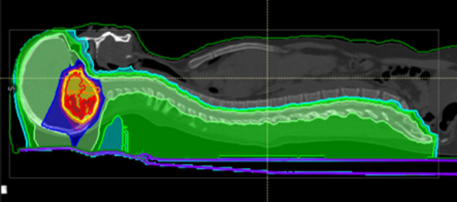 Cuenta atrás para la Unidad de Protonterapia y el edificio de Consultas externas Cuenta atrás para la Unidad de Protonterapia y el edificio de Consultas externas