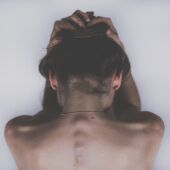 Imagen de archivo de una mujer sufriendo dolor de cabeza