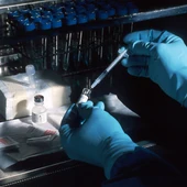La UB abre una investigación por la muerte de un científico que estudiaba la enfermedad de Creutzfeldt-Jakob La UB abre una investigación por la muerte de un científico que estudiaba la enfermedad de Creutzfeldt-Jakob