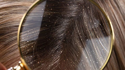 Centros Capilares Grasman