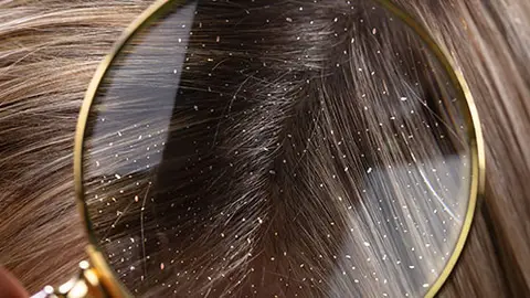 Centros Capilares Grasman Centros Capilares Grasman