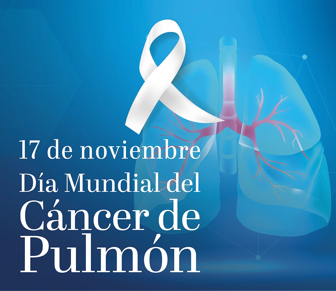 Día Mundial del Cáncer de Pulmón: los neumólogos anuncian el comienzo del proyecto 'Cassandra' para la detección precoz Día Mundial del Cáncer de Pulmón: los neumólogos anuncian el comienzo del proyecto 'Cassandra' para la detección precoz