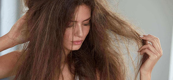 Se me cae mucho el pelo en otoño. ¿Qué hago? Visita Grasman en Dolores y Elche Se me cae mucho el pelo en otoño. ¿Qué hago? Visita Grasman en Dolores y Elche