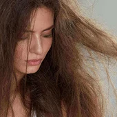 Prevenir la caída del cabello y soluciones para la alopecia, con centros capilares GRASMAN Prevenir la caída del cabello y soluciones para la alopecia, con centros capilares GRASMAN