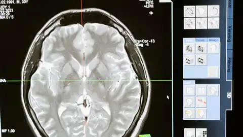 Radiografía del cerebro humano Radiografía del cerebro humano
