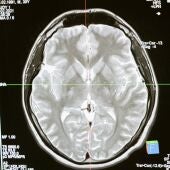 Radiografía del cerebro humano 