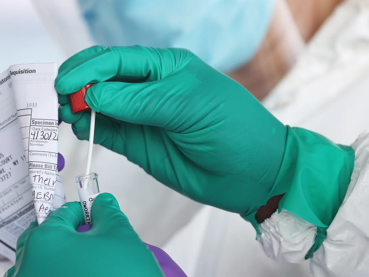Descubre los síntomas de la nueva variante de COVID-19 que ya se está extendiendo rápidamente por Europa 10 Merca2.es Contagiosidad y comparación con otras variantes