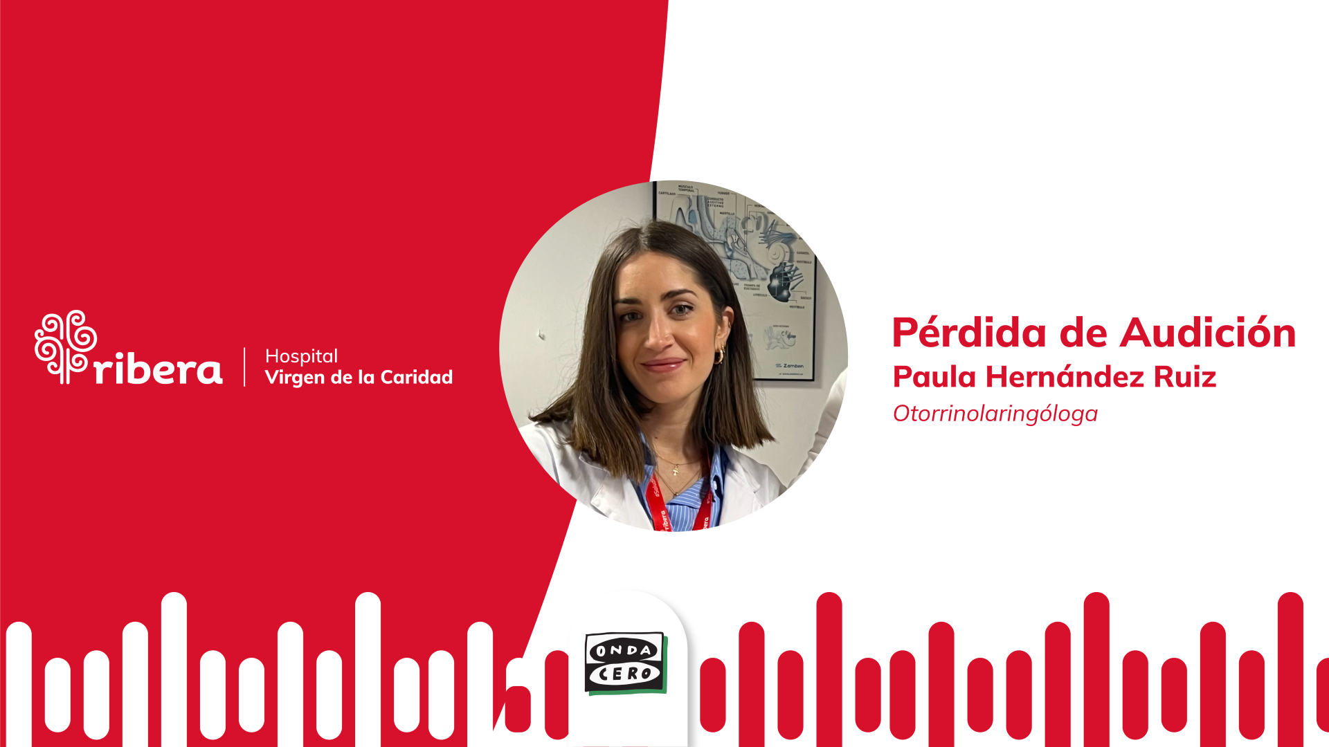 Hospital Ribera Virgen de la Caridad "Día Mundial de la Audición" Hospital Ribera Virgen de la Caridad "Día Mundial de la Audición"