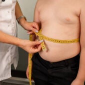 Preocupa el incremento de sobrepeso infantil